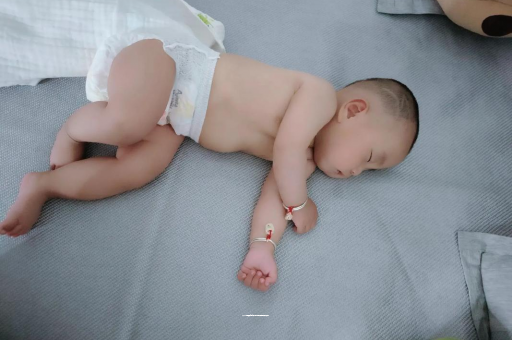 响水宝宝头上长痱子